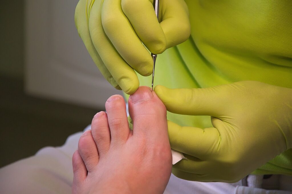 foot care, podiatry, treatment-3557103.jpg